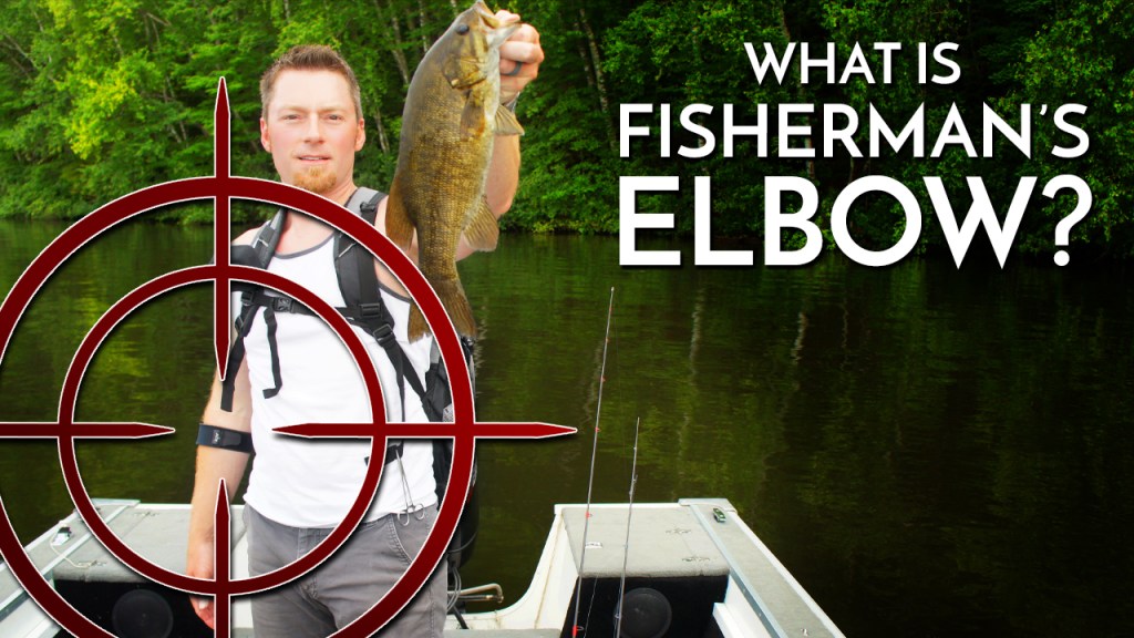 What is Fisherman's Elbow?